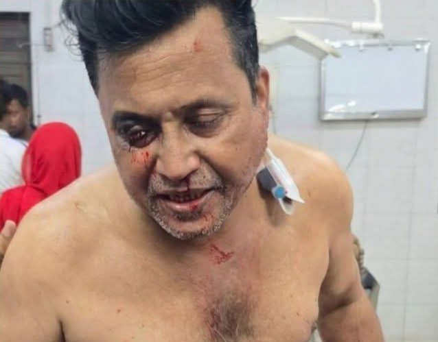 আওয়ামী লীগ নেতাকে লক্ষ্য করে গুলিবর্ষণ : মুমূর্ষু অবস্থায় হাসপাতালে ভর্তি