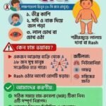 টিকাদানে গাফিলতির মাসুল দিচ্ছে শিশুরা ! ১০জেলায় হামের ভয়াবহ সংক্রমণ