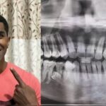 ৪২ দাঁত নিয়ে গিনেস রেকর্ড গড়লেন মালয়েশিয়ার প্রথাব