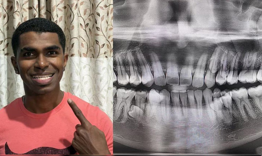 ৪২ দাঁত নিয়ে গিনেস রেকর্ড গড়লেন মালয়েশিয়ার প্রথাব