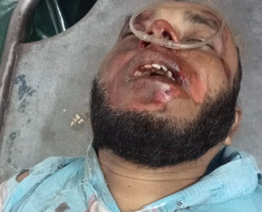 যশোরে ট্রাকের ধাক্কায় কলেজ শিক্ষক নিহত