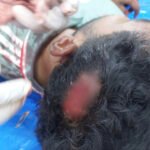 চৌগাছায় ছাত্রদল-যুবদল সংঘর্ষ : আহত ৩ 