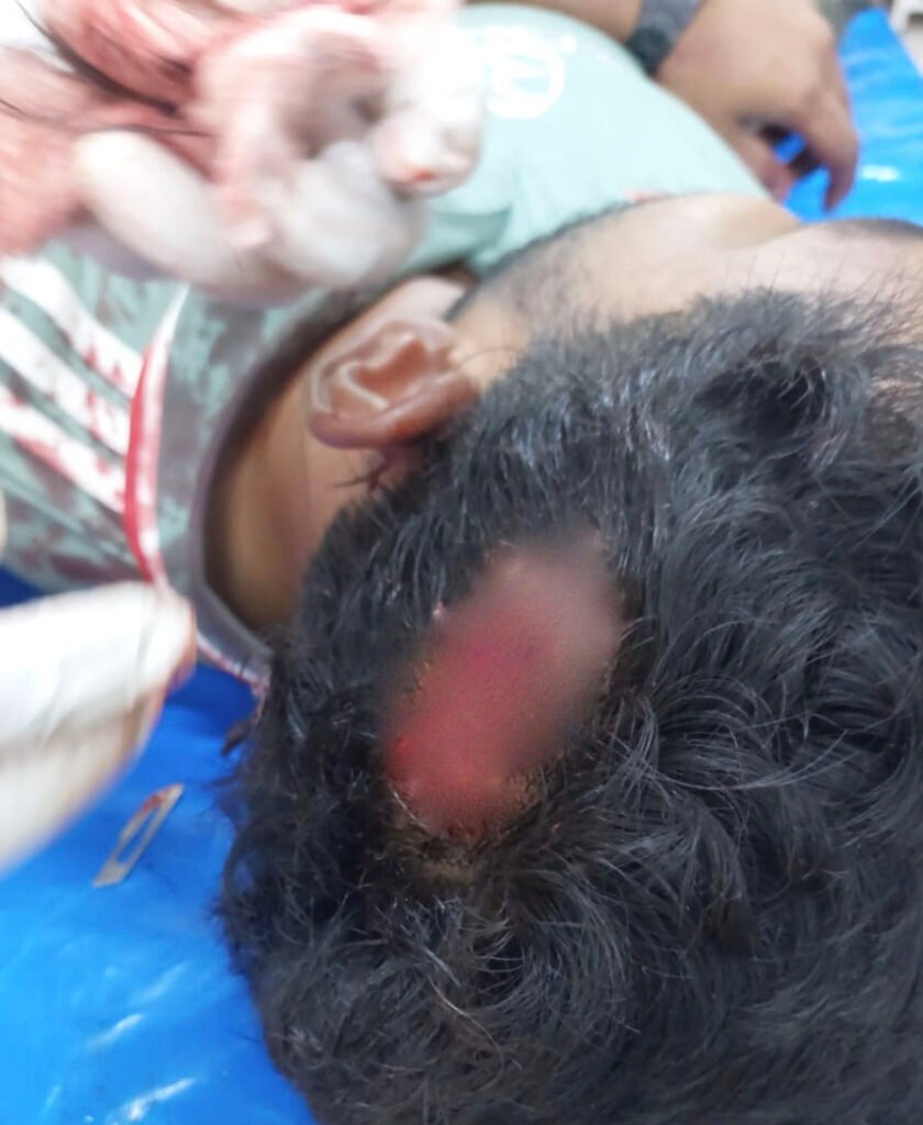 চৌগাছায় ছাত্রদল-যুবদল সংঘর্ষ : আহত ৩ 