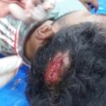 চৌগাছায় ছাত্রদল-যুবদল সংঘর্ষ : আহত ৩