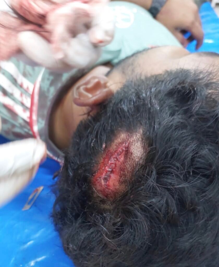 চৌগাছায় ছাত্রদল-যুবদল সংঘর্ষ : আহত ৩