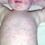 সন্দেহজনক আরও ৪মৃত্যু ও নতুন আক্রান্তের খবরে উদ্বেগ