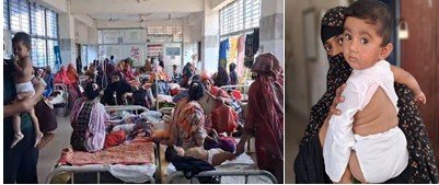 হামে আক্রান্ত রোগীদের চিকিৎসায় ছিল না প্রস্তুতি : মানা হয়নি স্বাস্থ্য মন্ত্রণালয়ের নির্দেশ।